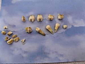 CatBagz.com Presents - Twelve Days of Catmas - Day Two - A set of real human teeth that are super grody.